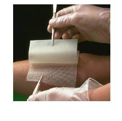 GARZA MEDICATA BACTIGRAS CON CLOREXIDINA ACETATO 0,5% 10X10CM 10 PEZZI - Fontenova srl