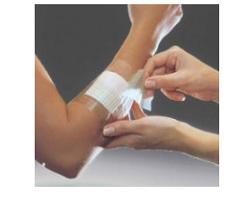 FILM ADESIVO IN POLIURETANO IN ROTOLO TRASPARENTE IMPERMEABILE PER FISSAGGIO DI MEDICAZIONI E CATETERI 10X1000CM 1 PEZZO - Fontenova srl